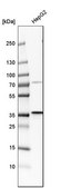 Anti-PSMD14 antibody produced in rabbit Prestige Antibodies&#174; Powered by Atlas Antibodies, affinity isolated antibody, buffered aqueous glycerol solution