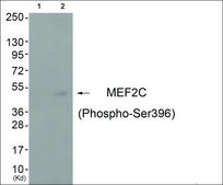 Anti-phospho-MEF2C (pSer396) antibody produced in rabbit affinity isolated antibody