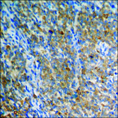 Anti-phospho-CaMK2 (pThr286) antibody produced in rabbit affinity isolated antibody