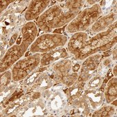 Anti-AHSG antibody produced in rabbit Prestige Antibodies&#174; Powered by Atlas Antibodies, affinity isolated antibody, buffered aqueous glycerol solution