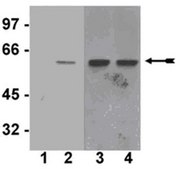 Anti-phospho-Akt1/PKB&#945; (Ser473) Antibody, clone SK703, rabbit monoclonal culture supernatant, clone SK703, Upstate&#174;