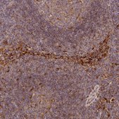 Anti-LGALS9 antibody produced in rabbit Prestige Antibodies&#174; Powered by Atlas Antibodies, affinity isolated antibody, buffered aqueous glycerol solution