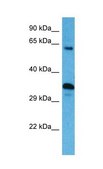 Anti-SRC antibody produced in rabbit affinity isolated antibody