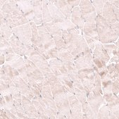 Anti-NELL1 antibody produced in rabbit Prestige Antibodies&#174; Powered by Atlas Antibodies, affinity isolated antibody, buffered aqueous glycerol solution