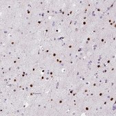 Monoclonal Anti-ZEB1 antibody produced in mouse Prestige Antibodies&#174; Powered by Atlas Antibodies, clone CL0151, purified immunoglobulin, buffered aqueous glycerol solution
