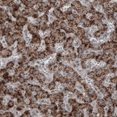 Monoclonal Anti-ACAA1 antibody produced in mouse Prestige Antibodies&#174; Powered by Atlas Antibodies, clone CL2663, purified immunoglobulin, buffered aqueous glycerol solution
