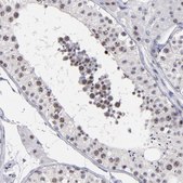 Anti-RAF1 antibody produced in rabbit Prestige Antibodies&#174; Powered by Atlas Antibodies, affinity isolated antibody, buffered aqueous glycerol solution