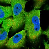 Anti-NFKBIA antibody produced in rabbit Prestige Antibodies&#174; Powered by Atlas Antibodies, affinity isolated antibody, buffered aqueous glycerol solution