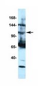 Anti-TRPM4 antibody produced in rabbit affinity isolated antibody