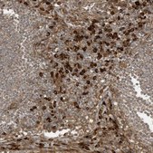 Anti-DDIT4 antibody produced in rabbit Prestige Antibodies&#174; Powered by Atlas Antibodies, affinity isolated antibody, buffered aqueous glycerol solution