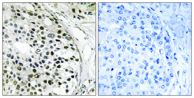 Anti-MNK1 antibody produced in rabbit affinity isolated antibody