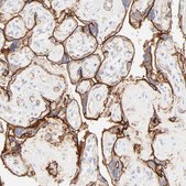 Anti-ITGA5 antibody produced in rabbit Prestige Antibodies® Powered by Atlas Antibodies, affinity isolated antibody, buffered aqueous glycerol solution