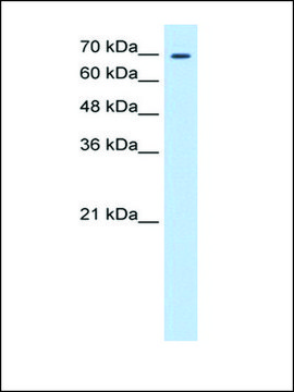 Anti-TGM2 (AB2) antibody produced in rabbit affinity isolated antibody
