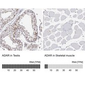Anti-ADAR antibody produced in rabbit Prestige Antibodies&#174; Powered by Atlas Antibodies, affinity isolated antibody, buffered aqueous glycerol solution