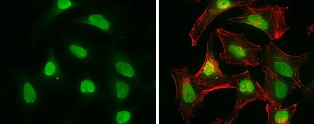 Monoclonal Anti-RBBP8 antibody produced in mouse