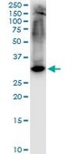Monoclonal Anti-STX1A antibody produced in mouse clone 1B11-1A8, purified immunoglobulin, buffered aqueous solution