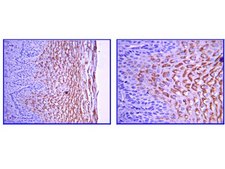 Anti-Laminin gamma 1 Antibody, clone A5 clone A5, Chemicon&#174;, from rat
