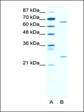 Anti-FOXK2 (AB2) antibody produced in rabbit IgG fraction of antiserum