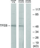 Anti-TFEB antibody produced in rabbit affinity isolated antibody