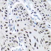 Anti-SMN1 Antibody, clone 9N9Q6, Rabbit Monoclonal