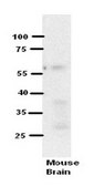 Anti-RCAN1 affinity isolated antibody
