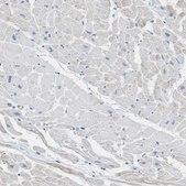 Anti-MYH11 antibody produced in rabbit Prestige Antibodies&#174; Powered by Atlas Antibodies, affinity isolated antibody, buffered aqueous glycerol solution