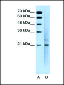 Anti-MUC1 affinity isolated antibody
