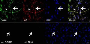 Anti-Na+K+ ATPase &#945;-2 Antibody serum, Upstate&#174;