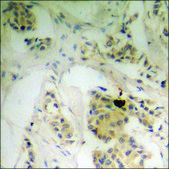 Anti-phospho-Vinculin (pTyr821) antibody produced in rabbit affinity isolated antibody