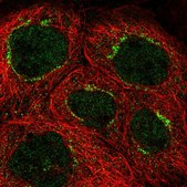 Anti-CEP83 antibody produced in rabbit Prestige Antibodies&#174; Powered by Atlas Antibodies, affinity isolated antibody, buffered aqueous glycerol solution