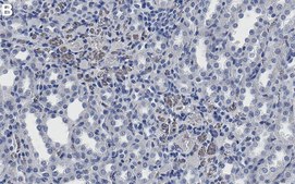 Anti-C-Reactive Protein Antibody, clone 1J2 ZooMAb&#174; Rabbit Monoclonal recombinant, expressed in HEK 293 cells