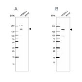 Anti-SALL4 antibody produced in rabbit Prestige Antibodies® Powered by Atlas Antibodies, affinity isolated antibody, buffered aqueous glycerol solution