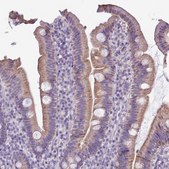 Anti-ALDH2 antibody produced in rabbit Prestige Antibodies&#174; Powered by Atlas Antibodies, affinity isolated antibody, buffered aqueous glycerol solution