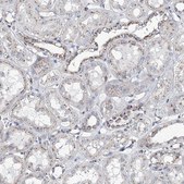 Anti-MAN1A2 antibody produced in rabbit Prestige Antibodies&#174; Powered by Atlas Antibodies, affinity isolated antibody, buffered aqueous glycerol solution