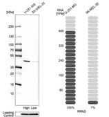 Anti-RRM2 antibody produced in rabbit Prestige Antibodies&#174; Powered by Atlas Antibodies, affinity isolated antibody, buffered aqueous glycerol solution