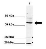 Anti-PDHA1 (AB1) antibody produced in rabbit IgG fraction of antiserum
