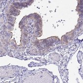 Anti-KCNMA1 antibody produced in rabbit Prestige Antibodies&#174; Powered by Atlas Antibodies, affinity isolated antibody, buffered aqueous glycerol solution