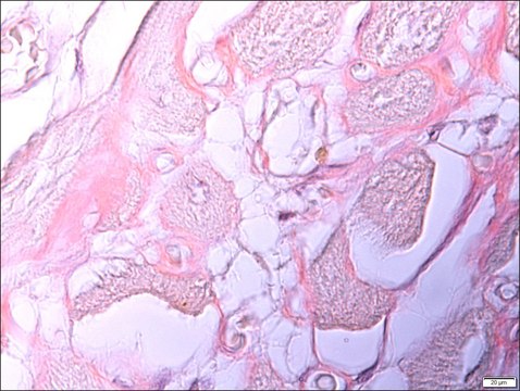 Amyloid Stain, Congo Red