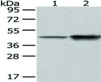 Anti-CD14 affinity isolated antibody