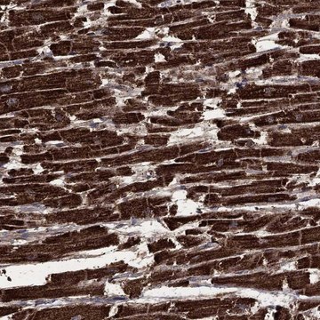 Anti-Got2 Antibody Produced In Rabbit Prestige Antibodies&#174; Powered by Atlas Antibodies, affinity isolated antibody, buffered aqueous glycerol solution