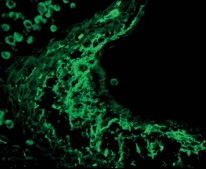 Anti-Tenascin Antibody Chemicon&#174;, from rabbit