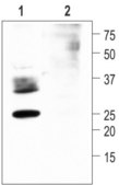 Anti-Water Channel Aquaporin 2 antibody produced in rabbit IgG fraction of antiserum, lyophilized powder
