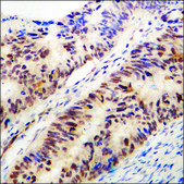 Anti-phospho-Estrogen Receptor-&#945; (pSer118) antibody produced in rabbit affinity isolated antibody