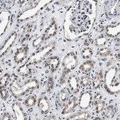 Anti-USP16 antibody produced in rabbit Prestige Antibodies&#174; Powered by Atlas Antibodies, affinity isolated antibody, buffered aqueous glycerol solution