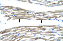 Anti-FABP3 antibody produced in rabbit IgG fraction of antiserum