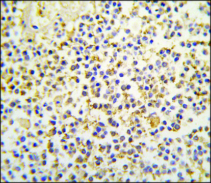 Anti-ALDH1A3 (N-term) antibody produced in rabbit saturated ammonium sulfate (SAS) precipitated, buffered aqueous solution