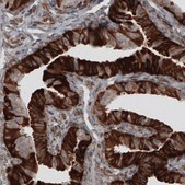Monoclonal Anti-PDIA3 antibody produced in mouse Prestige Antibodies&#174; Powered by Atlas Antibodies, clone CL2446, purified immunoglobulin, buffered aqueous glycerol solution