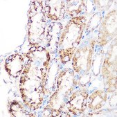 Anti-GLUD1 antibody produced in rabbit