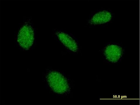 Anti-CAMK4 antibody produced in mouse purified immunoglobulin, buffered aqueous solution