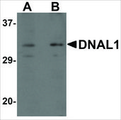 Anti-DNAL1 antibody produced in rabbit affinity isolated antibody, buffered aqueous solution